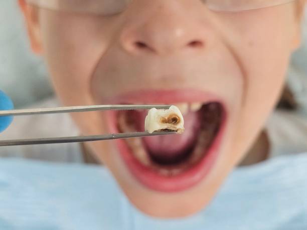 Best Pediatric Emergency Dentist in Ardia, CA